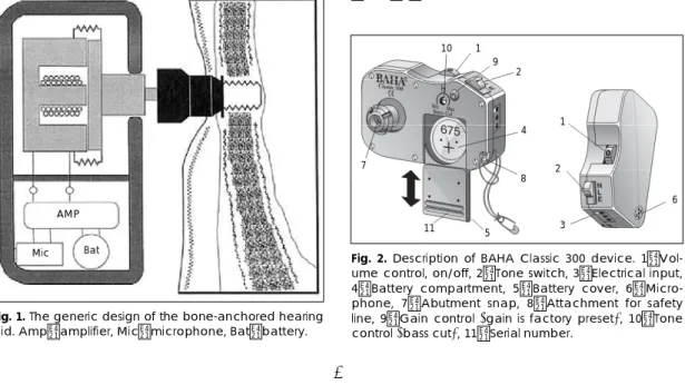 Fig.  2.  Description of BAHA Classic 300 device. 1：Vol- 1：Vol-ume control, on/off, 2：Tone switch, 3：Electrical input,  4：Battery compartment, 5：Battery cover,  6：Micro-phone, 7：Abutment snap, 8：Attachment for safety  line, 9：Gain control (gain is factory 