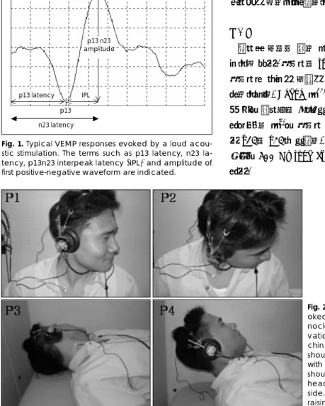 Fig. 1. Typical VEMP responses evoked by a loud acou- acou-stic stimulation. The terms such as p13 latency, n23  la-tency, p13n23 interpeak latency (IPL) and amplitude of first positive-negative waveform are indicated.
