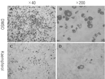 Fig. 3. Kaempferol reduces lipid accumulation in differentiated 3T3-L1 adipocytes. 3T3-L1 cells were differentiated and treated with DMSO, Kaempferol (40 μM)