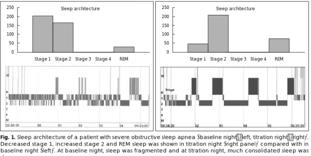 Fig. 1. Sleep architecture of a patient with severe obstructive sleep apnea (baseline night：left, titration night：right).