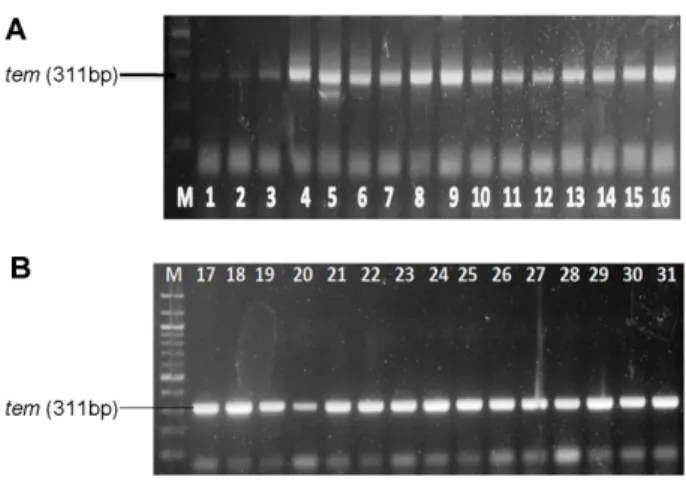 Fig. 3. Plasmid Profile of Isolates. Lanes 5-6, 10-11, 14-15, 17- 17-19 show band of plamids