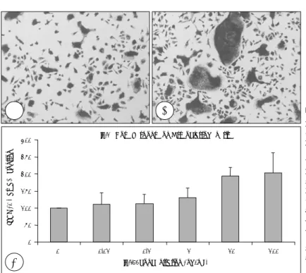 Fig. 3. IL-1 receptor antagonist (IL-1ra) blocks the upre- upre-gulatory effect of IL-1β on osteoclastogenesis