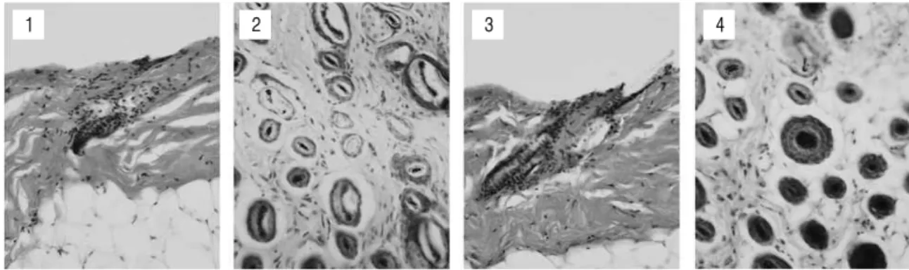 Fig. 4. Representative sections of H&amp;E stained skin tissues of C57BL/6 mouse at 14th day