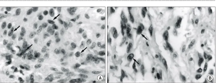 Fig.  1.  Immunohistochemical  staining  of  formalin-fixed  paraffin-embeded  specimens  of  the  gastrointestinal  stromal  tumors