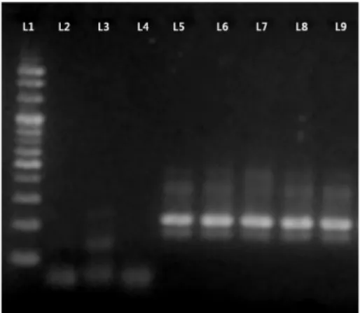 Fig. 2. Melting temperature analysis for the peptide nucleic acid melting array.  ※A: Cryptosporidium parvum, B: Giardia lamblia, C: Entamoeba histolytica, D: T