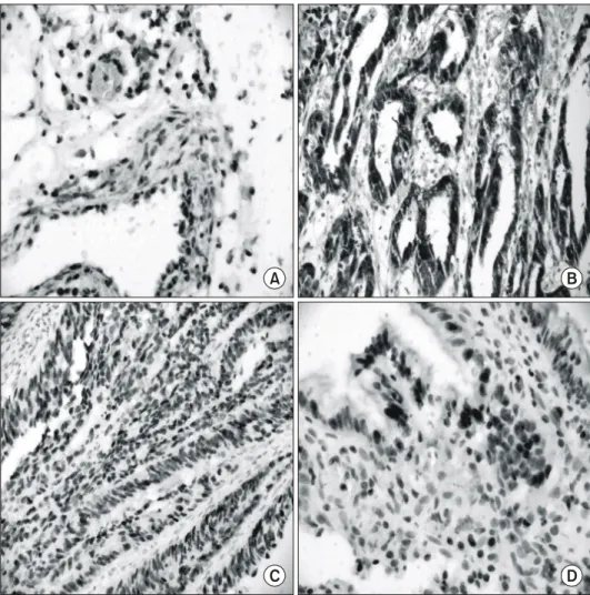 Fig.  1.    Immunohistochemical  staining  of  p14 ARF  (A),  p16 INK4a  (B),  p53  (C),  pRb  (D).