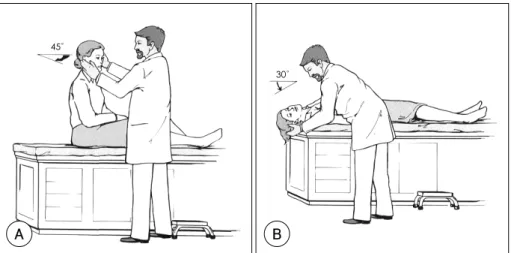 Fig. 2. Side-lying test (right ear). The subject’s head is tur- tur-ned with the nose pointing 45°away from the side to be tested (The head is turned left)