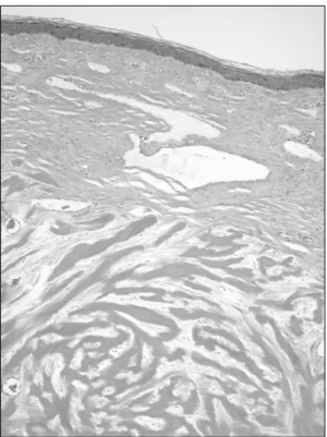 Fig. 2. Higher magnification shows loosely packed coll- coll-agen bundle with overabundant extracellular matrix (H 