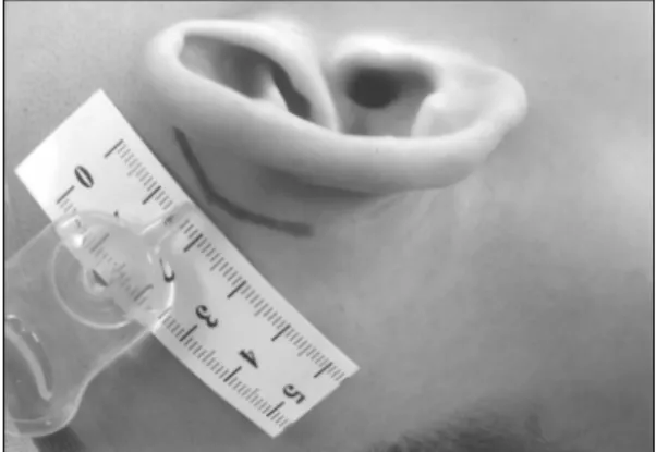 Fig. 2. The patient is rotated toward the surgeon to obtain the appropriate surgical view