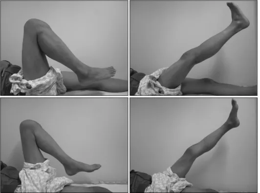 Fig.  4.  Intraoperative  findings.  The  ruptured  quadriceps  tendon  was  sutured  using  a  pull-out  technique.