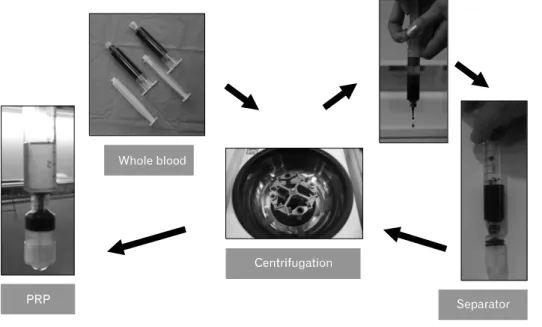 Fig.  1.  Preparation  of  platelet  rich  plasma  (PRP).기대하고 사용되고 있다.  회전근개 파열,  주관절 건증,  아킬레스 건증 등에 PRP를 이용하여 좋은 치료 결과를 얻었다는 보고가 있으며,  슬개건염에서도 몇몇 연구 결과가 보고되어 있다