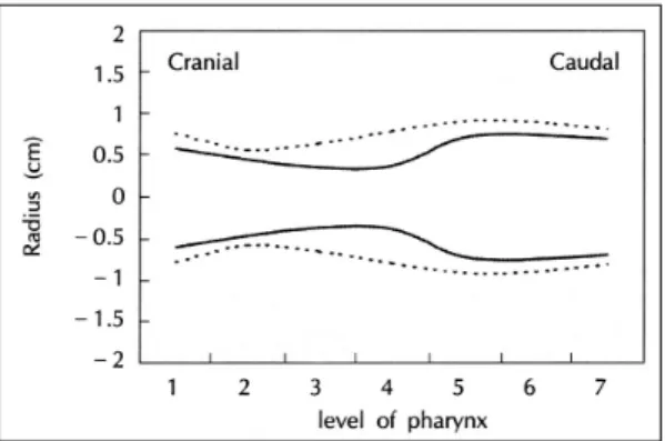 Fig. 8. The simulated longitudinal images of the orop- orop-harynx were made by transformation of the numeric  data of cross-sectional area to a linear graphic display  of oropharyngeal diameter