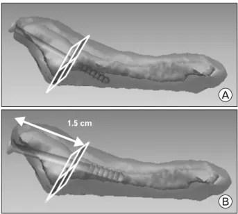 Fig.  1.  Bicortical  screw  fixation  (A),  Intramedullary  screw fixation  (B)  model
