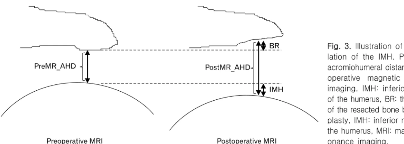 Fig.  3.  Illustration  of  the  calcu- calcu-lation  of  the  IMH.  PreMR_AHD: 