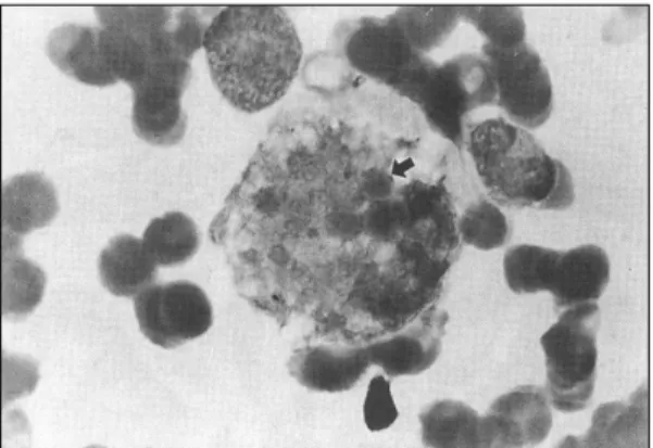 Fig. 5. Oil power examination of bone marrow smear. 