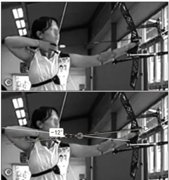 Fig. 2. Measure of scapular ele- ele-vation  angle  and  shoulder   ab-duction  angle.