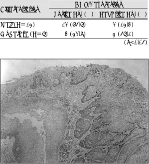 Fig. 3. Moderate differentiated squamous cell cancer of  the larynx showing weak or negative staining to  COX-2 antibody (H &amp; E,  ×100)