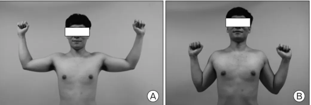 Fig. 1. Position of shoulder ex- ex-ternal  rotation  exercise.  (A)  90/ 