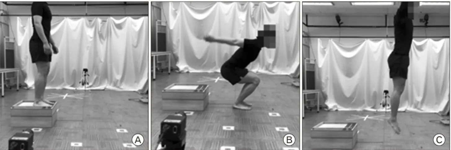 Fig.  2.  Static  postural  control.  Written  informed  consent  was obtained for publication of this study and  accompany-ing  images.
