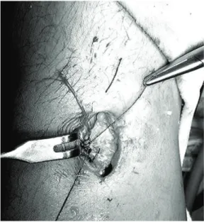 Fig.  3B.  Hyperflextion  isokinetic  testing.