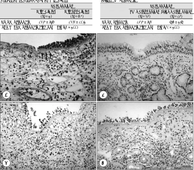 Table 2. Histopathologic classification and numbers of  infiltrated eosinophils  Nasal polyps  Edematous polyps  (N＝25)  Inflammatory polyps (N＝15)  No of eosinophil*  15.6±9.2 7.3±4.7 