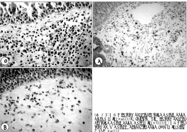 Fig. 3. I：H  &amp; E staining of chronic inflammatory polyp, plasma cells (×400). J：Toluidine blue staining of  chro-nic inflammatory polyp, mast cells (×200)
