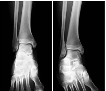 Fig.  2.  Immediately  postoperative  radiograph.