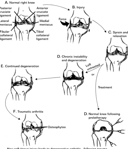 Fig. 2. Rationale of prolotherapy.