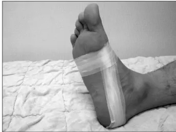 Fig.  1.  Low  dye  taping  technique.비스테로이드성 소염진통제,  국소 스테로이드 주사,  후족저부 쿠션,  보톡스 주사,  치료용 안창,  뒷꿈치 쿠션,  보조기 등이 있고,  특히 heel cup 기능이 있는 안창은 후족저부의 연부조직을 감싸거나 본래의 탄성을 유지할 수 있도록 해준다는 보고가 있다5-8).Low-dye (LD) 테이핑은 보전적인 치료 방법중의 하나로 Dr