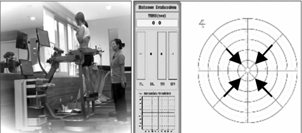 Fig.  3.  Measurement  of  maximum  voluntary  isometric  contraction. 
