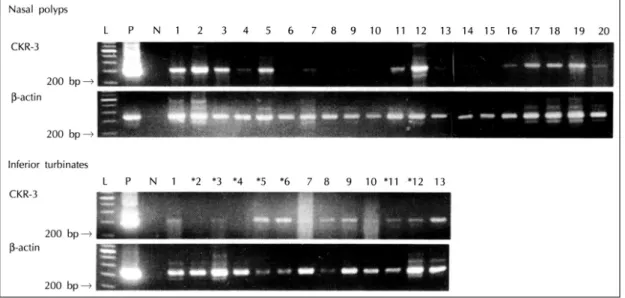 Fig. 3. Relationship between CCR3 mRNA expression and numbers of infiltrated eosinophils (r=0.877, p<0.001)