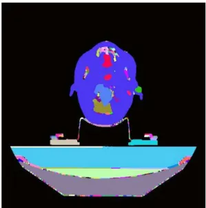 Fig. 5. Segmented CT slice with threshold value of 1% .