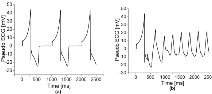 Fig. 9. Magnitude changes in normal MCG and in MCG during the re-entry wave activity.