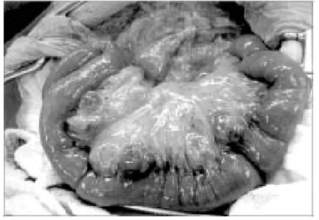 Fig.  3.  Radiologic  examination  with  gastrograffin  injection  shows  connection  between  the  diverticula  and  jejunal  lumen.