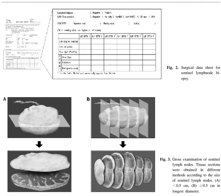Fig.  2.  Surgical  data  sheet  for  sentinel  lymphnode   bi-opsy.