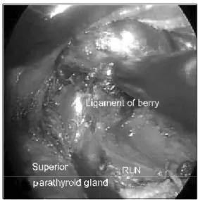 Fig.  4.  A  3  mm  closed  suction  drain  was  placed  at  the  site  of  the  0.5  cm  skin  incision