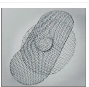 Fig.  1.  The  Prolene  Hernia  System.  A  typical  example  of  the  Prolene  Hernia  System  mesh  with  onlay  on  top  &amp;  the  underlay  below,  connected  by  a  cylindrical  structure.