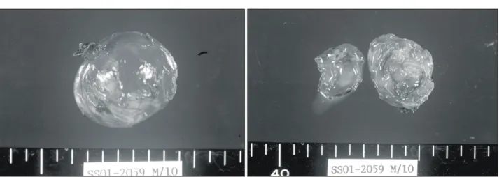 Fig.  6.  In  microscopic  examination,  pseudostratified  ciliated  columnar  epithelium  is  confirmed