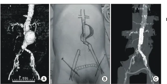 Table  2.  Procedures  and  related  findings