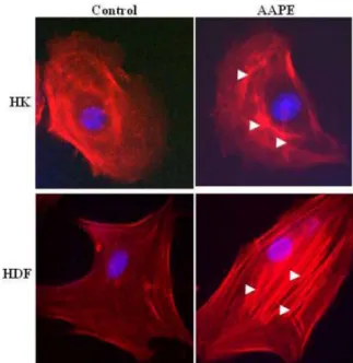 Fig. 4. DNA chip analysis. Functional classes of differentially regulated genes in HK incubated with AAPE