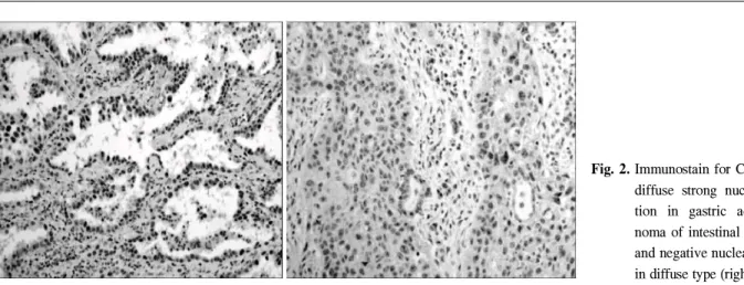 Table 3. Comparison of expression between p53 protein and CBP in gastric adenocarcinomas p53 protein (-) (+) (++) CBP (-) 43 (28.7) 10 (6.7) 7 (4.7) (+) 11 (7.2) 24 (16) 14 (9.3) (++) 7 (4.7) 1 (0.7) 33 (22) ( ) : % of positive cells.
