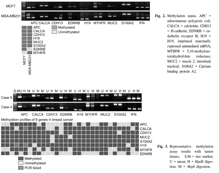 Fig. 3. Representative  methylation  assay  results  with  tumor  tissues.  　S.M  =  size  marker; 