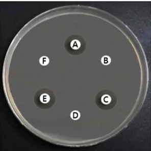 Table 2. Effects of heat treatments, enzymes, and pHs on the anti-bacterial activities present in the cell-free supernatants from Lc