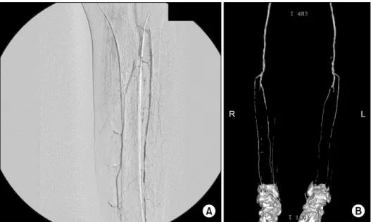 Table  3.  No.  of  Diagnostic  common  lesions  between  CA  and  MD-CTA