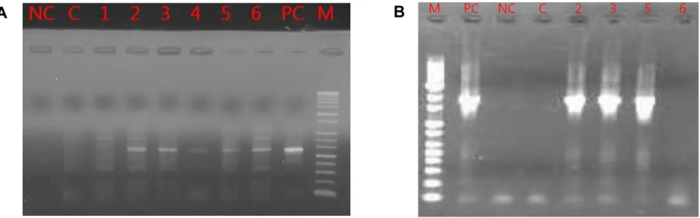 Fig. 4 Molecular analysis of transgenic lily plants by PCR analysis (A: bar gene (552 bp), B: AtSIZ (1,794 bp), (M: marker, PC: 
