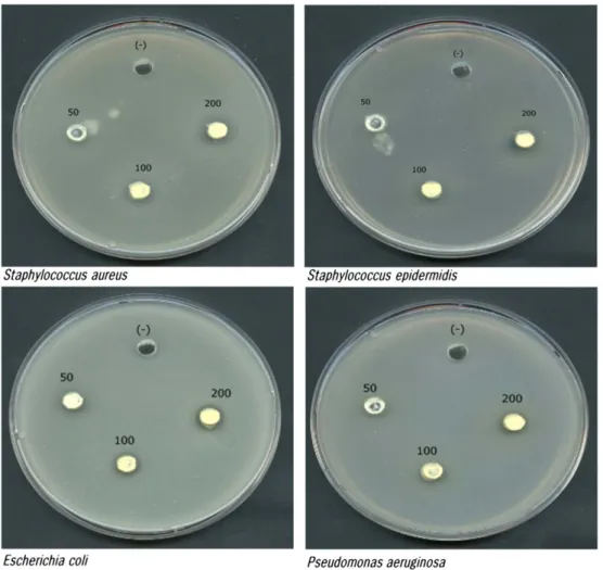Fig. 1. Antimicrobial activity of ethyl acetate extract of Asparagus cochinchinensis by using well diffusion methods