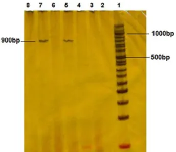 Fig. 4 Western blot analysis of hIL-11 protein expression in  transgenic tobacco plants