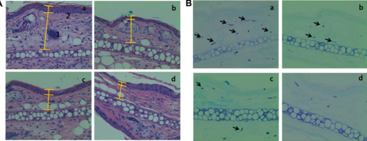 Fig. 7. Photomicrograph of transverse section  p &lt; 0.05ns of mice ears sensitized with topical application of 5% croton oil (v/v) in acetone (a-c) or vehicle acetone (d, non-inflamed), stained with hematoxylin-eosin (A) and toluidine-blue (B) examined u