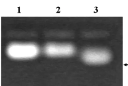 Fig. 3. Purification of Akt kinase by Ni 2+ -NTA affinity column chromatography. SDS-PAGE of the proteins during  purifica-tion step (left) and Western blot analysis with anti-Akt  mono-clonal antibodies (right) were performed