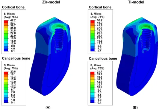 Figure 3. Equivalent stress distribution  for each implant materials under vertical  loading